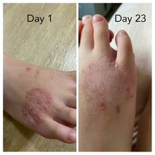 Load image into Gallery viewer, KARE Eczema Soother Toner - Sharyln & Co
