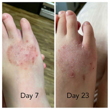 Load image into Gallery viewer, KARE Eczema Soother Toner - Sharyln & Co