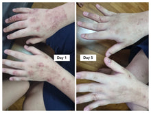Load image into Gallery viewer, KARE Eczema Soother Toner - Sharyln & Co
