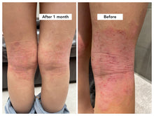 Load image into Gallery viewer, KARE Eczema Soother Toner - Sharyln & Co