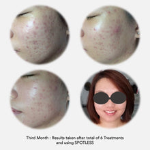 Load image into Gallery viewer, KYLN SPOTLESS Acne Serum. 20ml. - Sharyln & Co