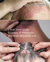 Load image into Gallery viewer, Scalp Eczema &amp; Psoriasis Relief Kit
